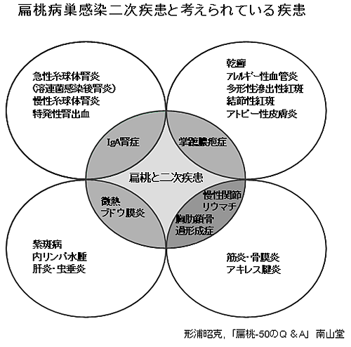 扁桃病巣感染二次疾患と考えられている疾患