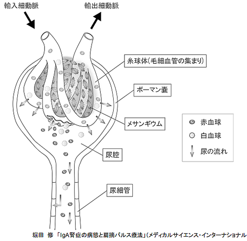 血尿、蛋白尿が出るメカニズム